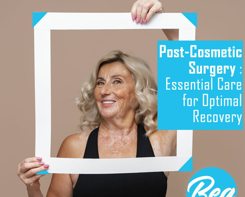 Post-Cosmetic Surgery : Essential Care for Optimal Recovery