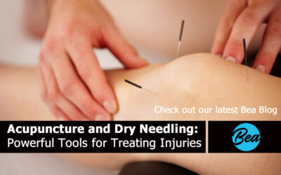 Acupuncture and Dry Needling: Powerful Tools for Treating Injuries