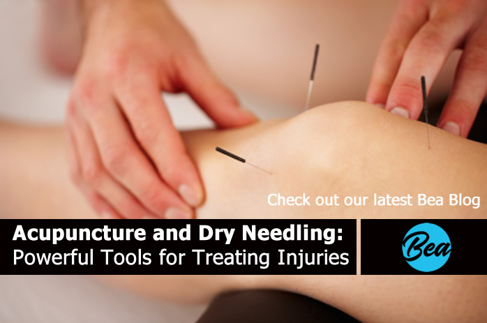 Acupuncture and Dry Needling: Powerful Tools for Treating Injuries