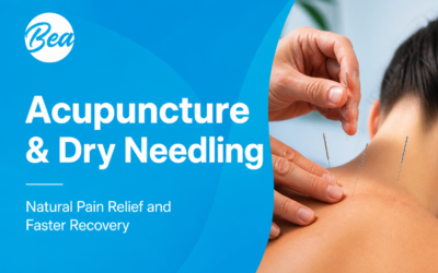 Acupuncture & Dry Needling
